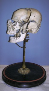 Beachene or 'exploded' skull, 19th century