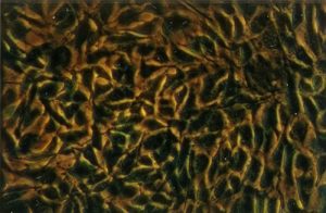 Shows dark background with textured golden brown shapes on top, from microscope image of cells